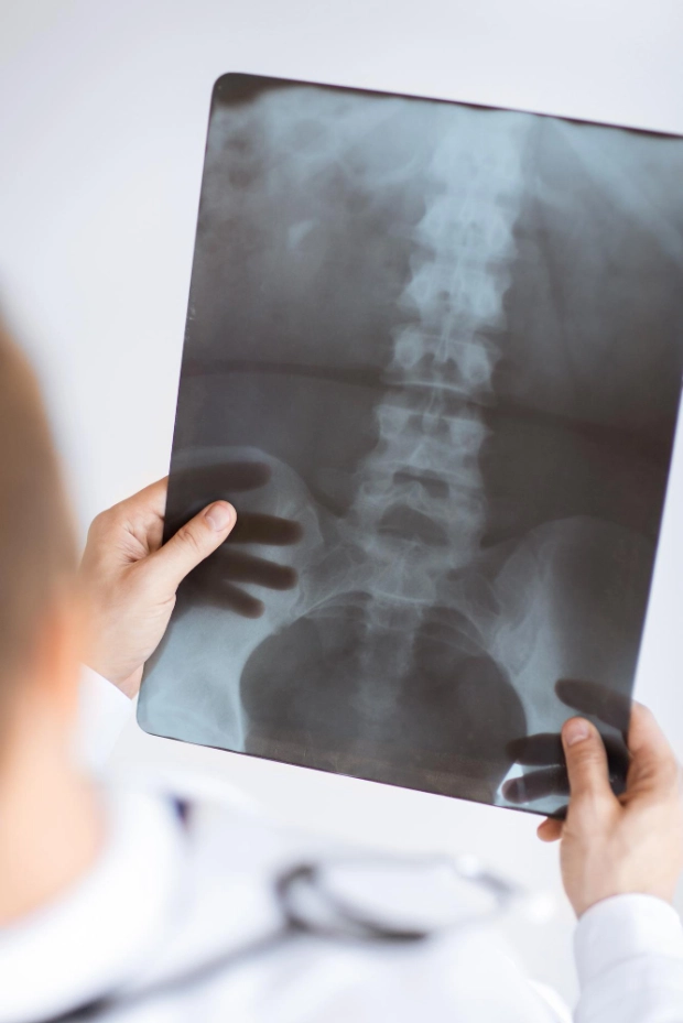 фото проведения рентгена в частной клинике